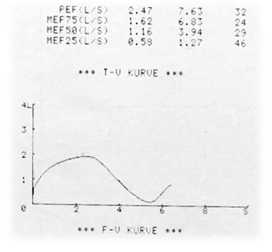 Dies ist eine von mehreren Kurven der Spirometrie, die der Computer ausdruckt und an der man den Krankheitszustand ablesen kann.